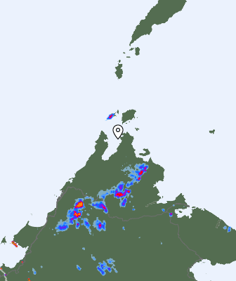 Radar