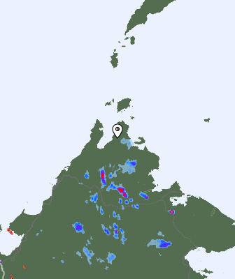 Radar
