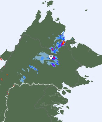 Radar