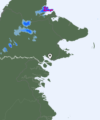 Radar