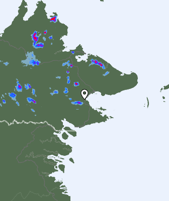 Radar