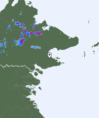 Radar