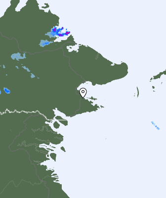 Radar
