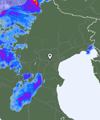 Radar