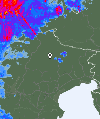 Radar