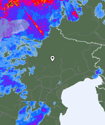Radar