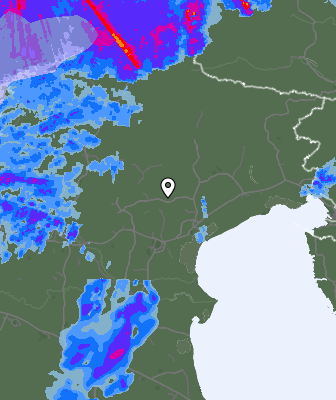 Radar