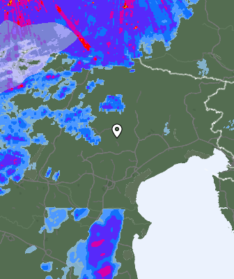 Radar