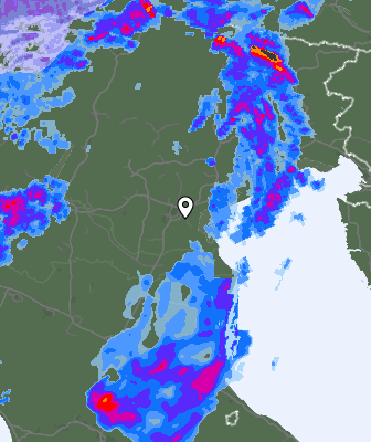 Radar
