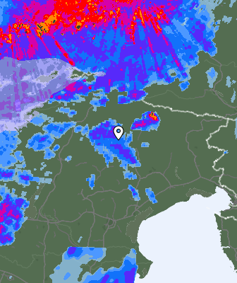 Radar