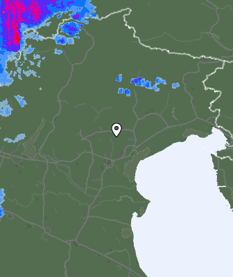 Radar