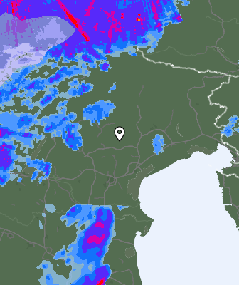 Radar
