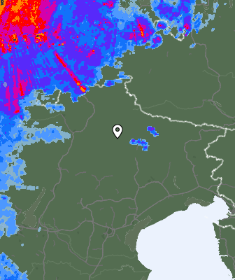 Radar