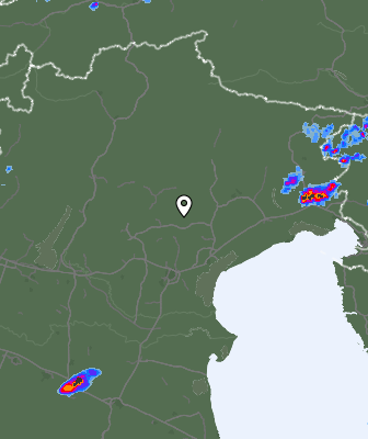 Radar