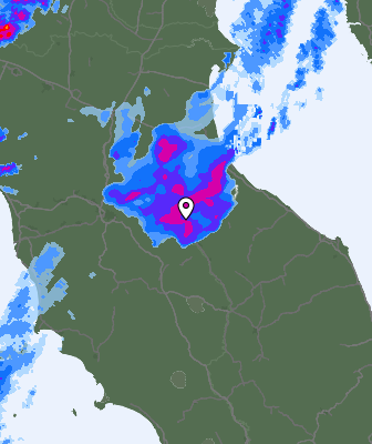 Radar