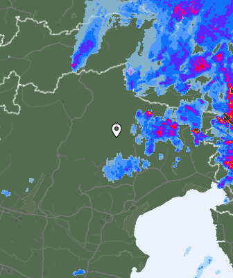 Radar