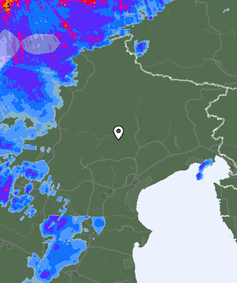 Radar