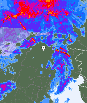 Radar