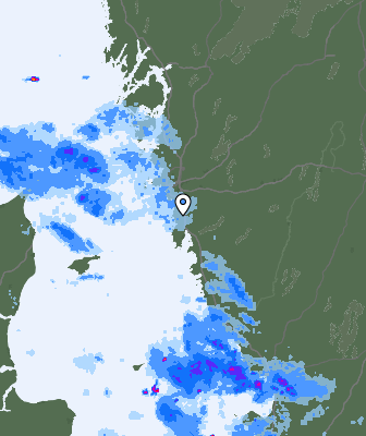 Radar