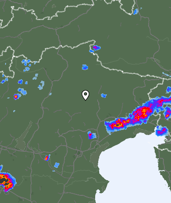 Radar