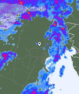 Radar