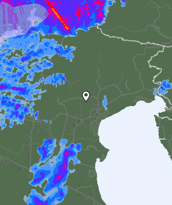 Radar