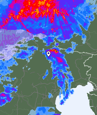 Radar