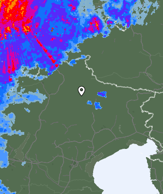 Radar