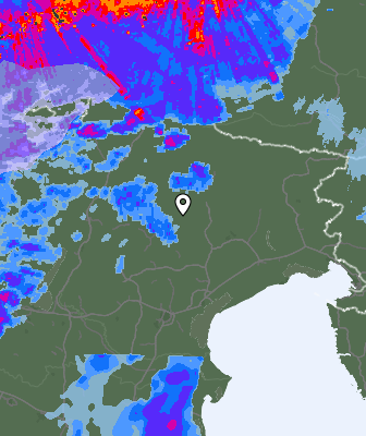 Radar