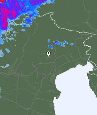 Radar