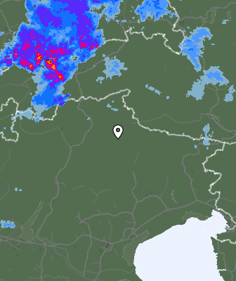 Radar