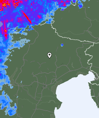 Radar