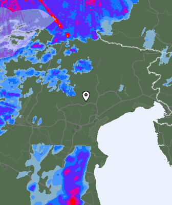 Radar