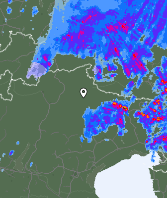 Radar