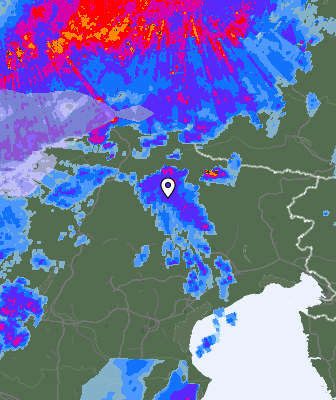 Radar