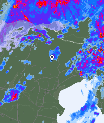 Radar