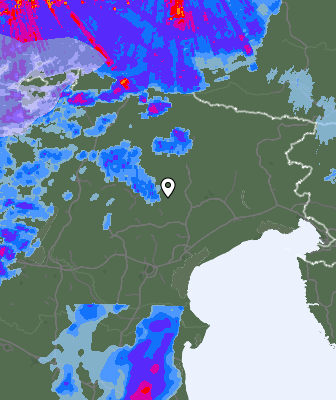 Radar