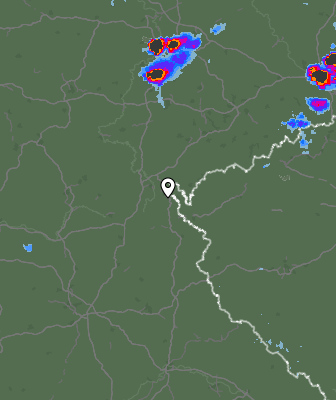 Radar