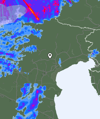 Radar
