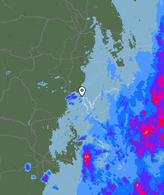 Radar
