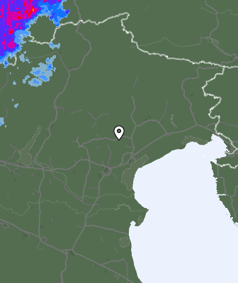 Radar