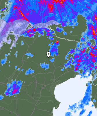 Radar