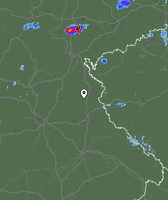 Radar