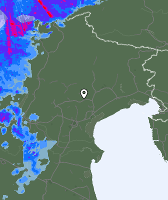 Radar