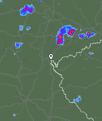 Radar