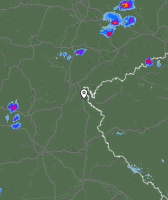 Radar