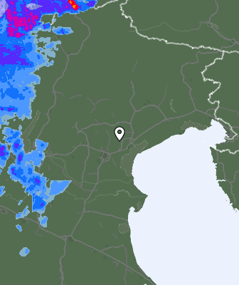 Radar
