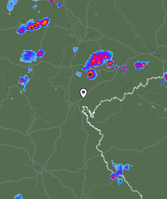 Radar
