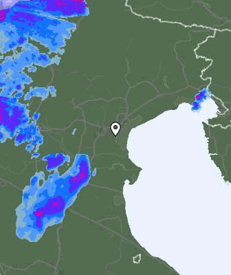 Radar