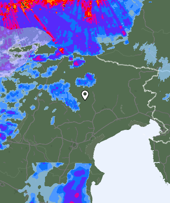 Radar